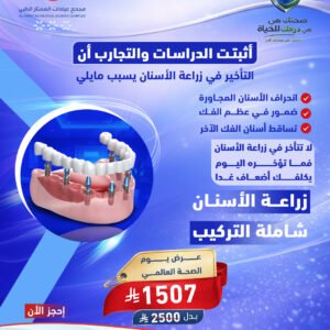 زراعة الاسنان