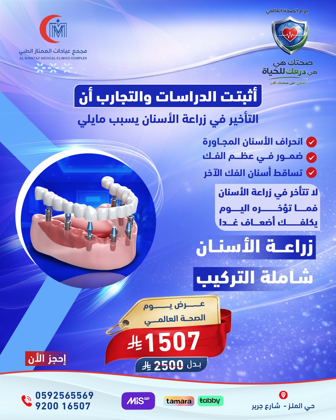 زراعة الاسنان