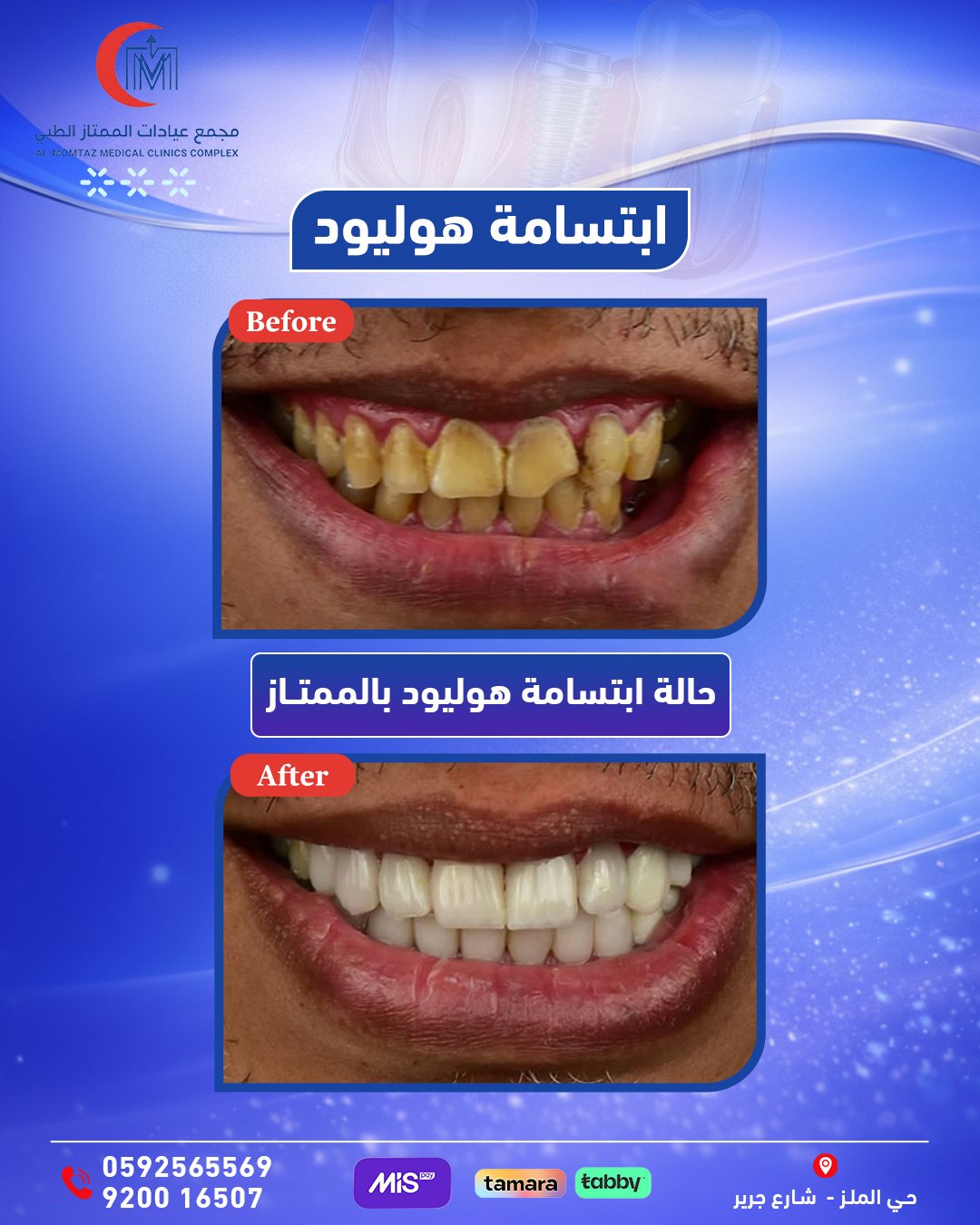 ابتاسمة هوليود