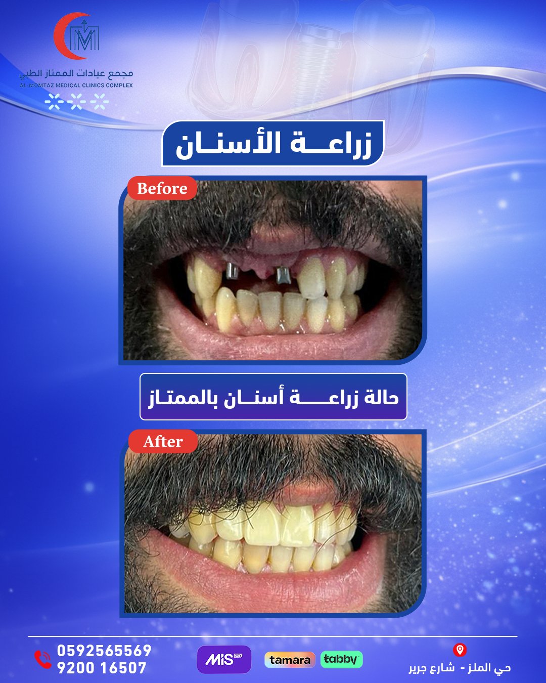 زراعة-...8